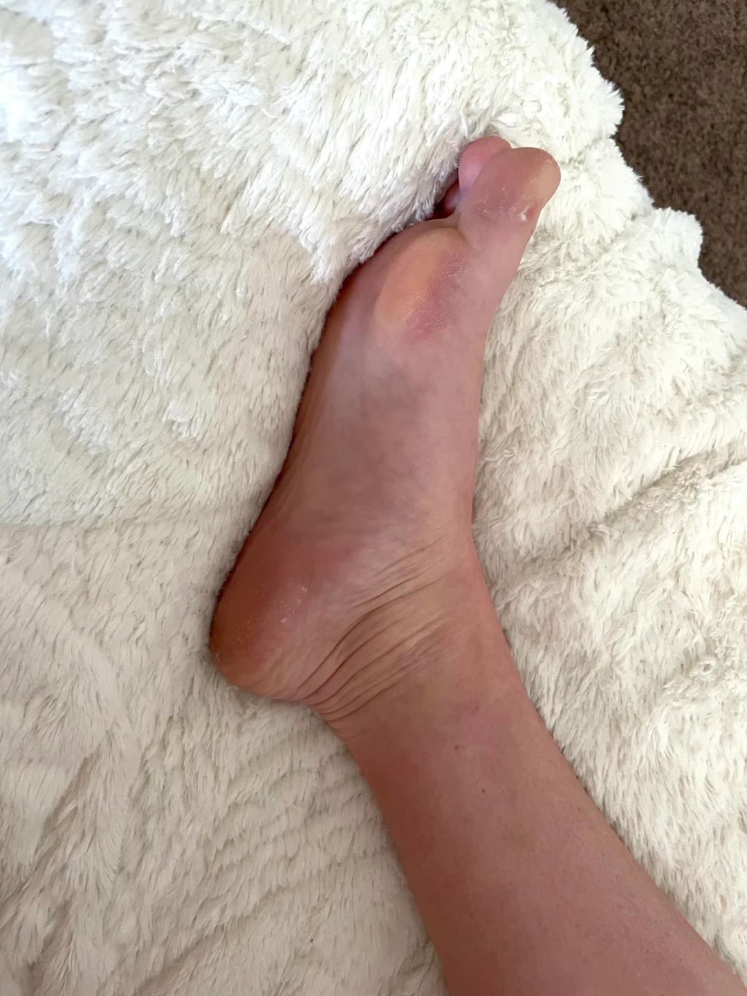 Before and after comparison: swollen puffy ankles vs. reduced swelling with normal ankle definition after using Moveno